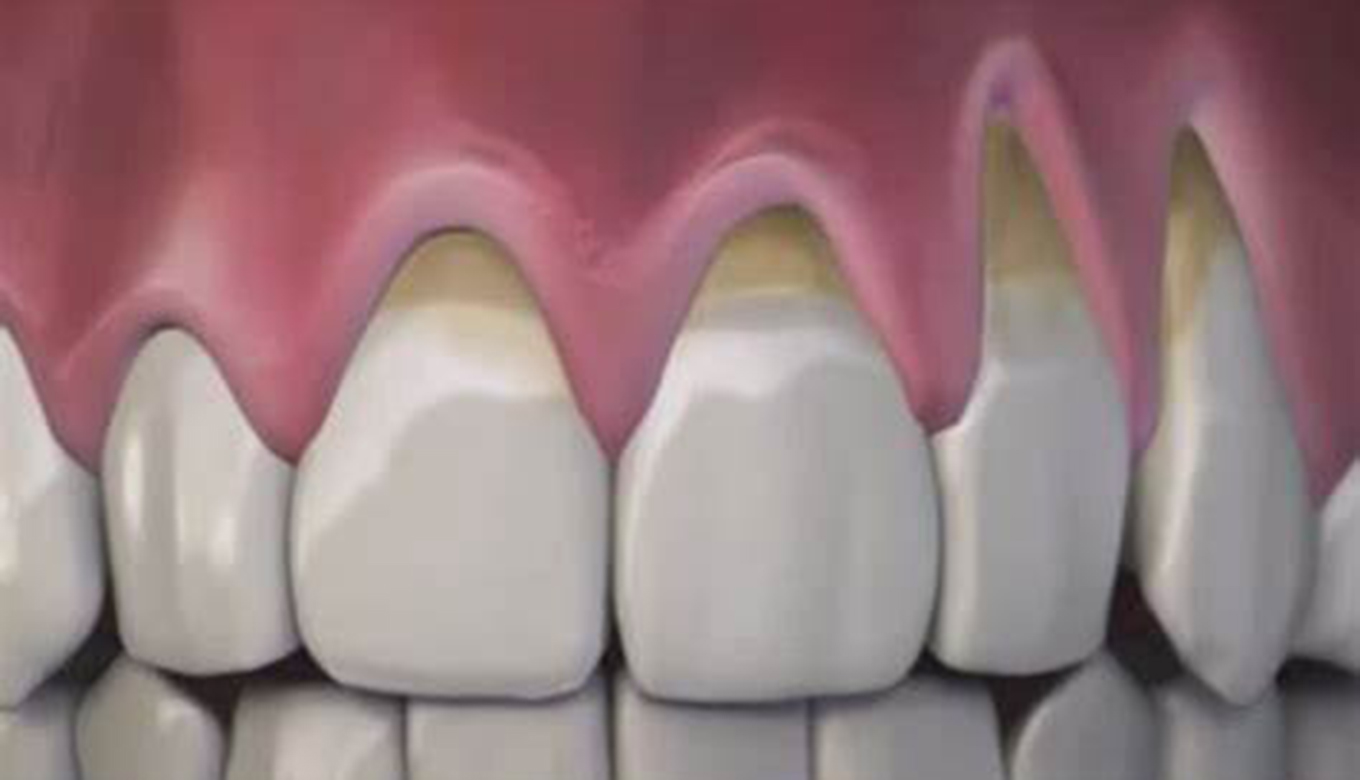 aloe vera teeth and gums