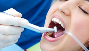 Deep Teeth Cleaning